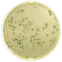 Listeria - Terreni cromogeni