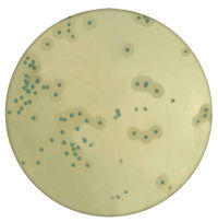 Listeria monocytogenes - Terreni cromogeni