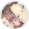 Salmonella - Terreni cromogeni