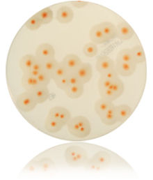 Bacillus cereus - terreni di coltura