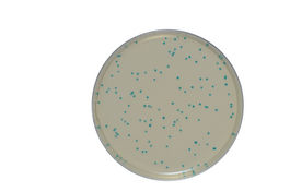 Listeria monocytogenes - Terreni cromogeni